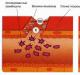 Norme agregacije trombocita u krvi i odstupanja